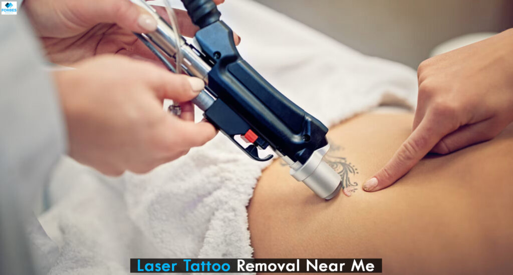 Laser Tattoo Removal Near Me